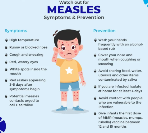Measles Information
